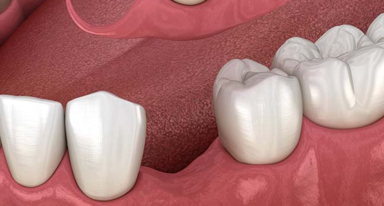 blog - Bullsmoor Dental & Aesthetics Clinic