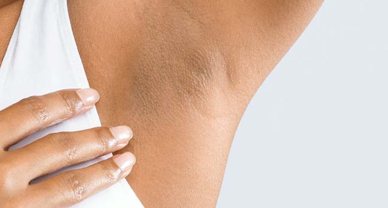 blog - Bullsmoor Dental & Aesthetics Clinic