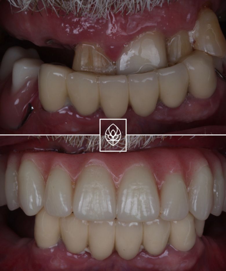 Before - Bullsmoor Dental