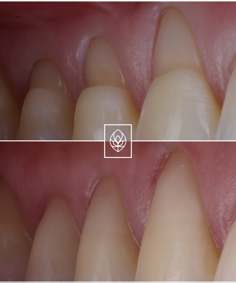 Before - Bullsmoor Dental