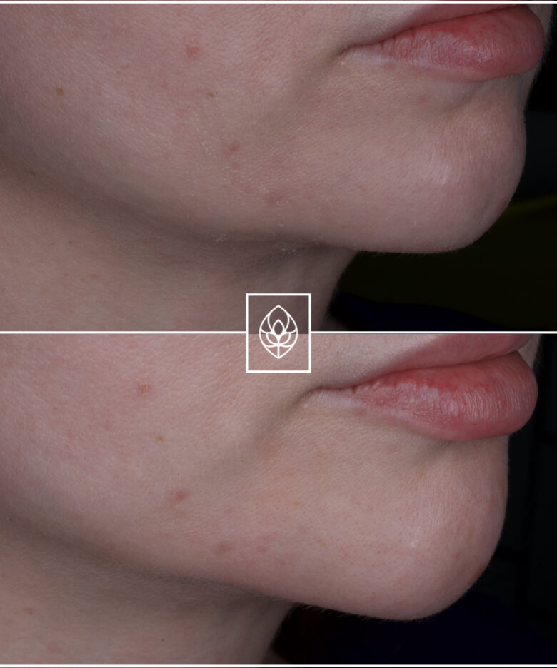 Before - Bullsmoor Dental