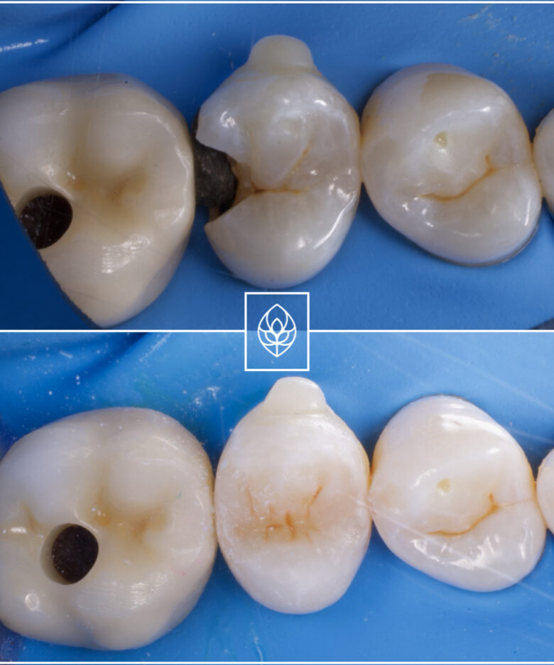 Before - Bullsmoor Dental